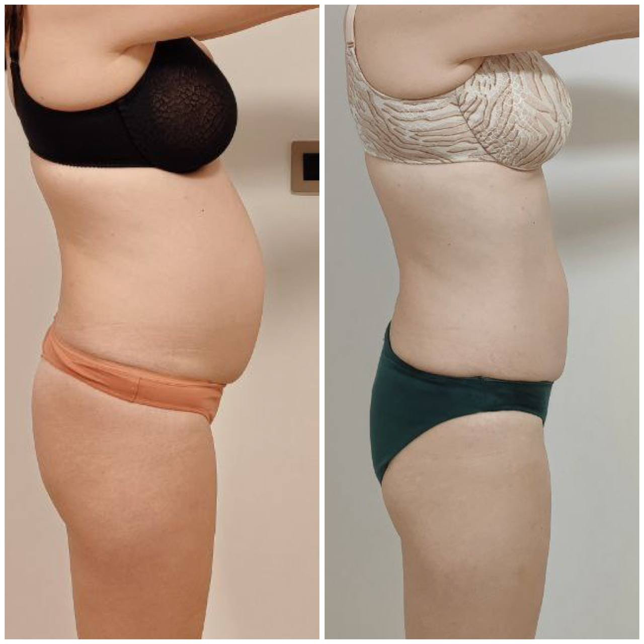 Transformación antes y después