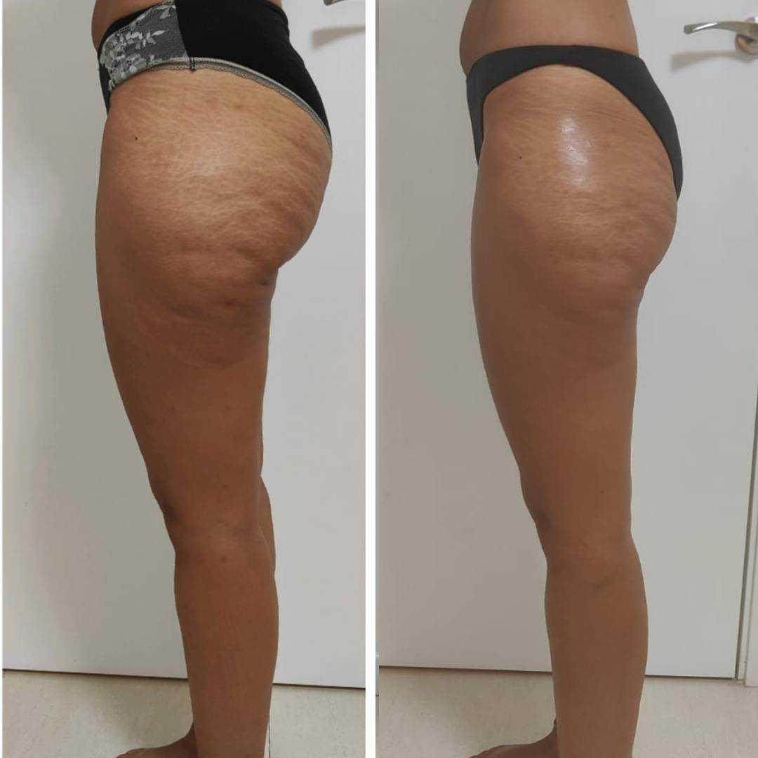 Transformación antes y después