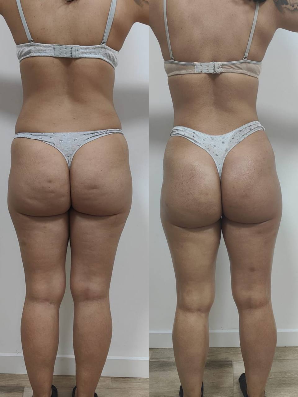 Transformación antes y después