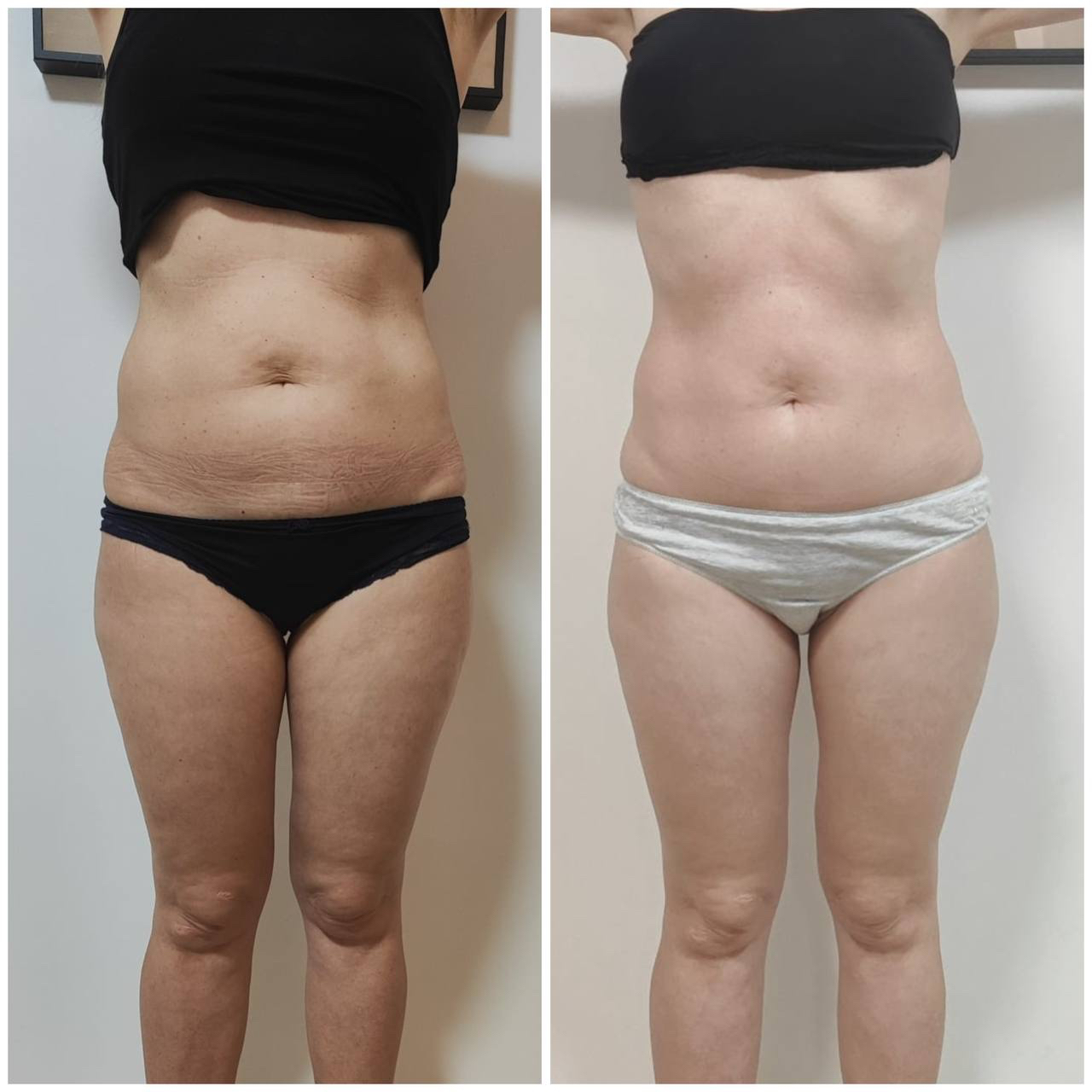 Transformación antes y después